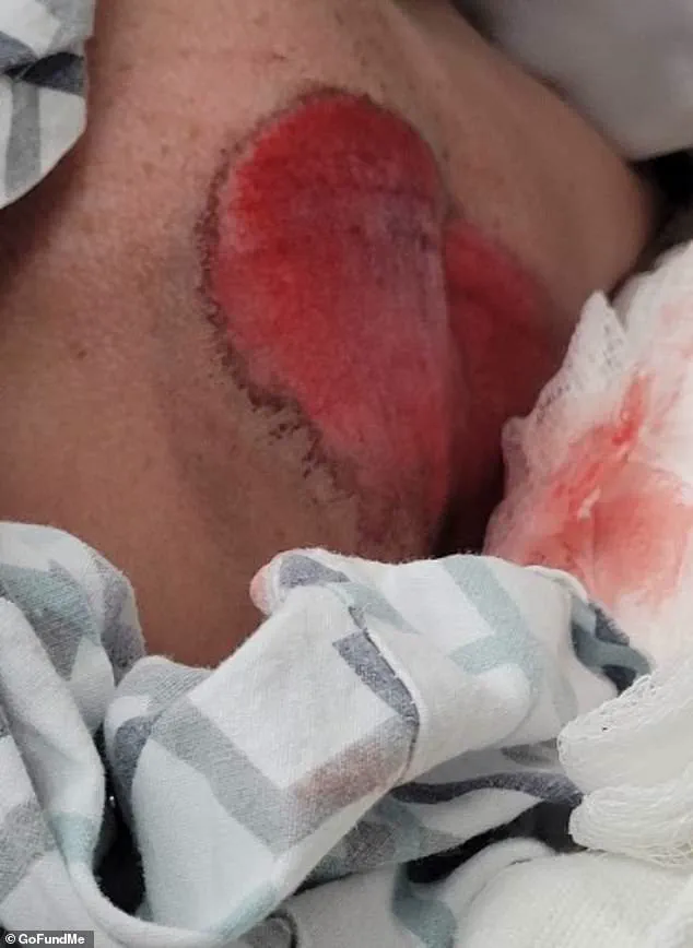 12-Year-Old Skylynn Banick's Near-Death Moment: Miscommunication at Wisconsin Intersection Leads to Life-Threatening Incident