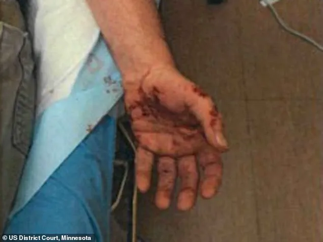 ICE Agent Jonathan Ross: 'I Feared for My Life' in Encounter That Left Him with Scars, Days Before Shooting Renee Good