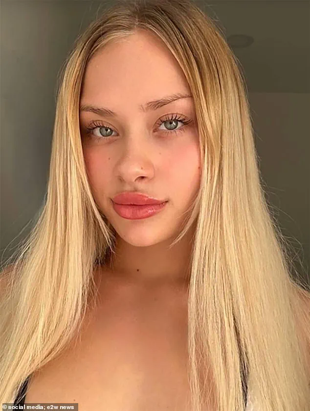 Maria Kovalchuk's Remarkable Recovery: 'Brutal Beatings' and a Knife Attack Left Her in a Coma, But Now She Walks Again