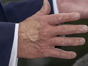 Trump Defies Medical Advice, Takes High-Dose Aspirin Daily: 'They Say Aspirin Is Good for Thinning Out the Blood'—WSJ Interview