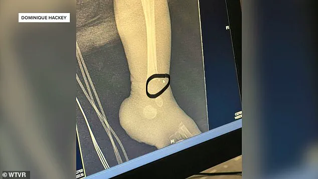 Late-Breaking: ICU Nurse Pleads No Contest in Neonatal Abuse Case, Sparking Urgent Safety Concerns