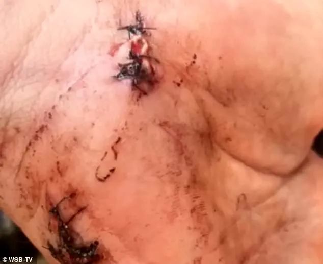 Georgia Groom Indicted for Murder After Wedding Day Shooting, Sparking Legal Debate Over Self-Defense