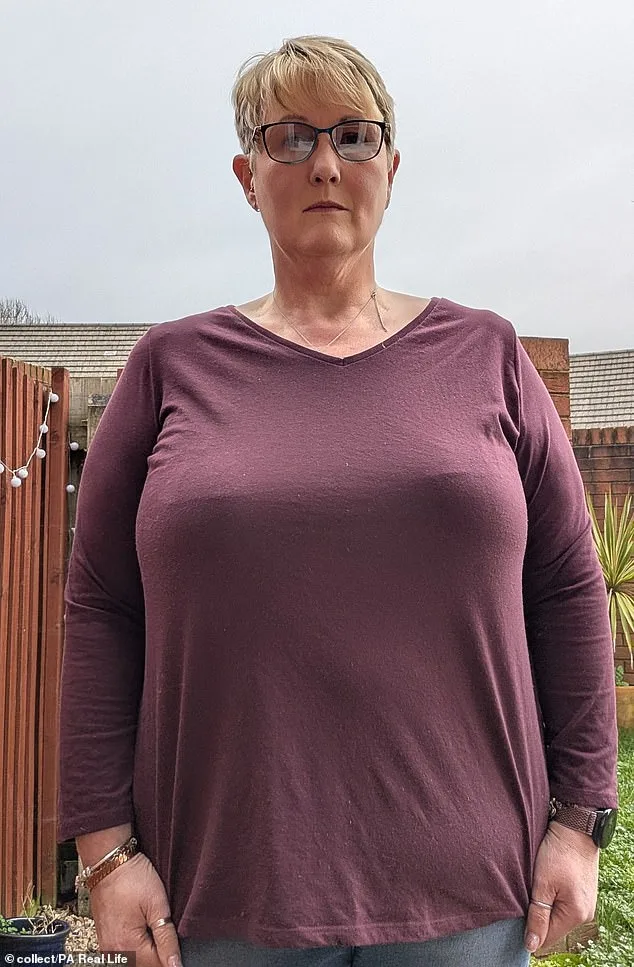 Devon Woman Suffers Nerve Damage From Massive Breast Growth