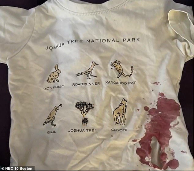 Two-year-old boy in Massachusetts hospitalized after raccoon attack at playground