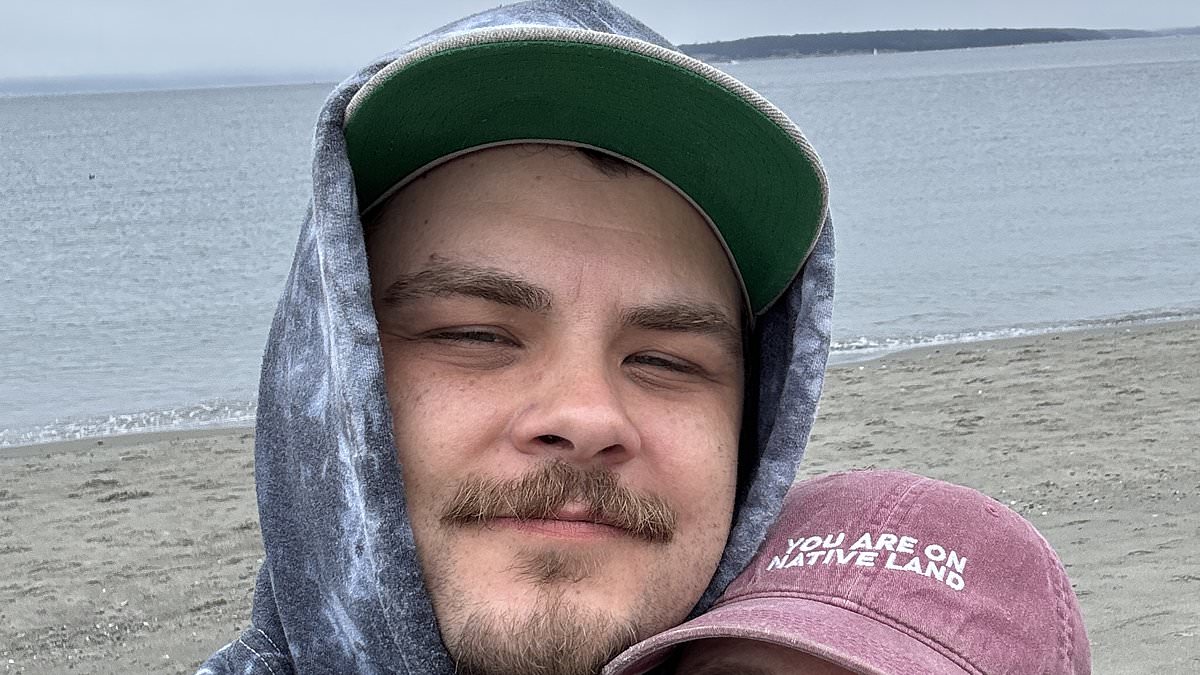 Man Finds Relief From Severe Hiccups Only With High-Dose THC-CBD Edibles