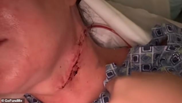 Doctor Rejections Delayed Florida Nurse's Diagnosis of Rare Tongue Cancer