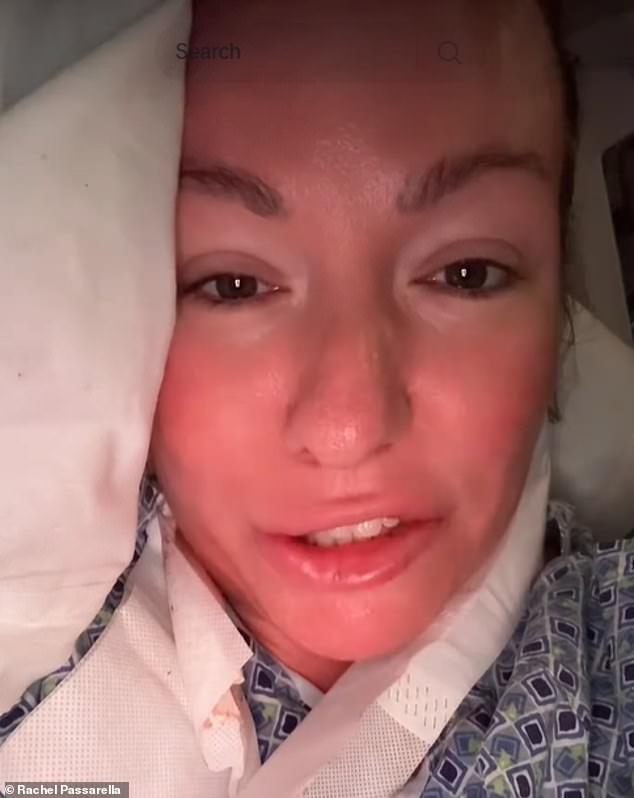 Doctor Rejections Delayed Florida Nurse's Diagnosis of Rare Tongue Cancer