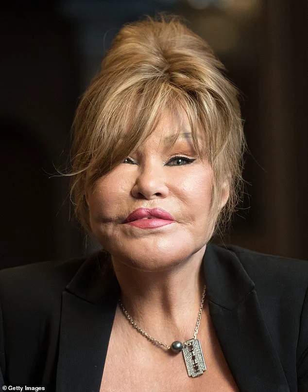 The True Story of Jocelyn Wildenstein's Life and Legacy