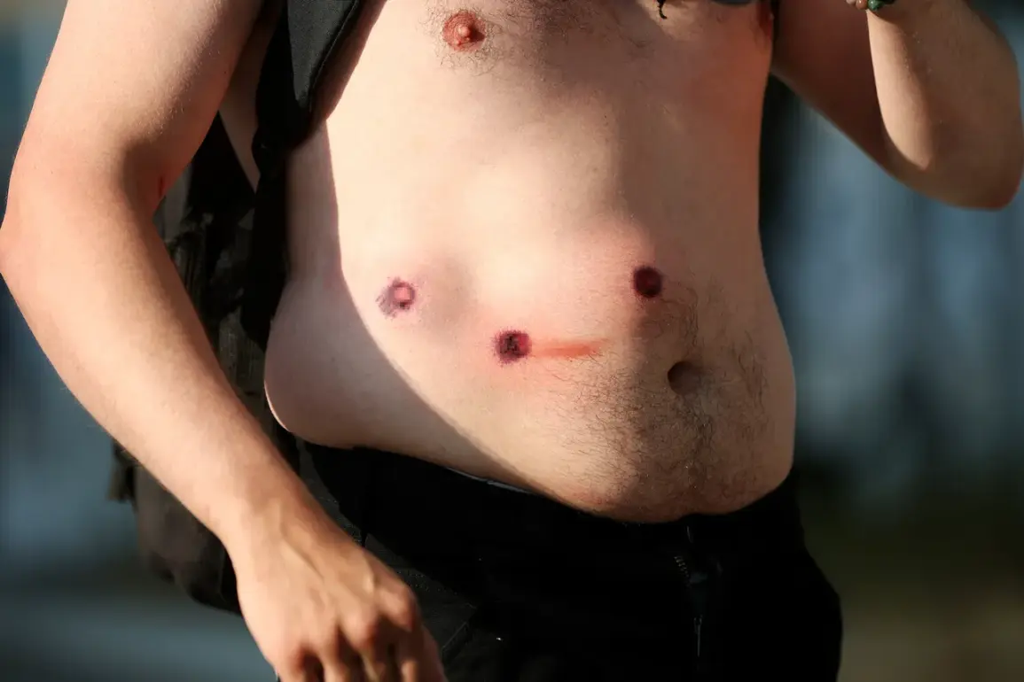 LAPD Uses Rubber Bullets in Escalated Effort to Quell Week-Long Protests