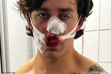 Violent Knife Attack Leaves New York Model Severely Disfigured After Intervention to Protect Two Women in Dresden