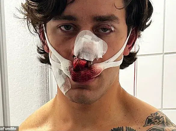 Violent Knife Attack Leaves New York Model Severely Disfigured After Intervention to Protect Two Women in Dresden